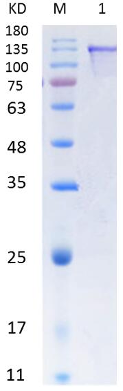 12% SDS-PAGE analysis profiles of purified PA4541-55-1417 (CBB stained).
